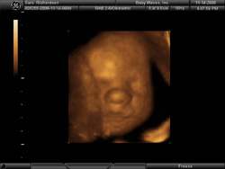 My Face - BabyWaves 3D