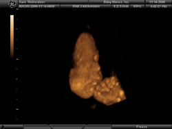 Thinker - BabyWaves 3D