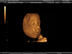 Profile - BabyWaves 3D Profile - BabyWaves 3D