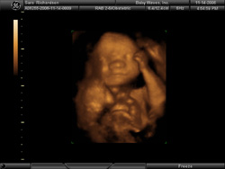 Upper Body - BabyWaves 3D