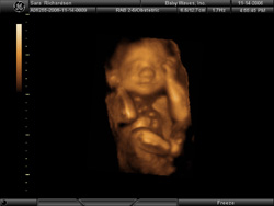 The Whole Me - BabyWaves 3D The Whole Me - BabyWaves 3D