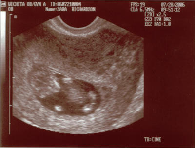First Sonogram Picture First Sonogram Picture